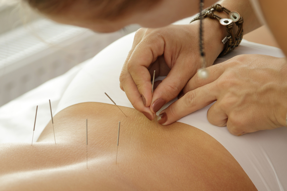 acupuncture points for lower back pain