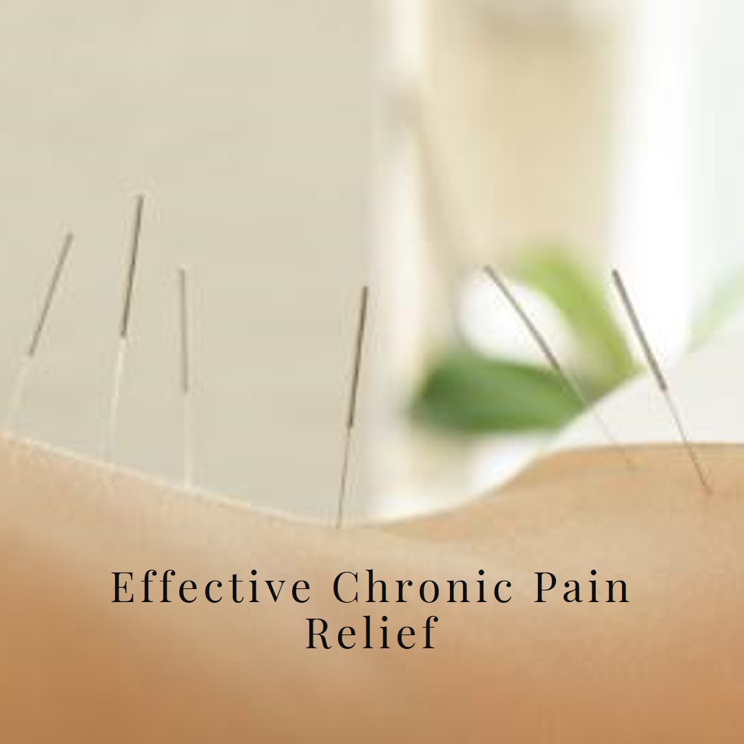 acupuncture Redmond wa